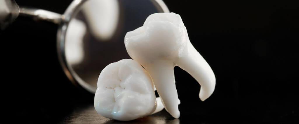 What Is a Deep Dental Cleaning? Understanding Scaling and Root Planing